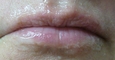 Lips before