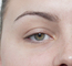 Eyes before