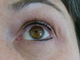 Eyes