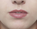 Lips after