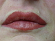 Lip blush treatment (after 1 week the appearance will be 40% softer and lighter)