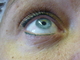 Eyes