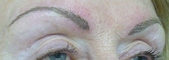 After Hair Stroke brow treatment (treatment will soften and lighten after 1 week)