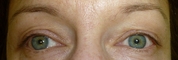 Before eyeliner