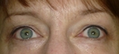 After eyeliner _top