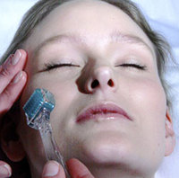 Derma Roller/Collagen Induction Therapy